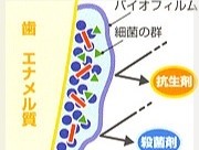 虫歯や歯周病の原因となるプラーク（細菌の塊）が歯の表面に形成する「バイオフィルム」の除去を、予防治療の中心に据えています