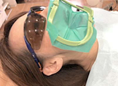 ラバーダム使用の様子