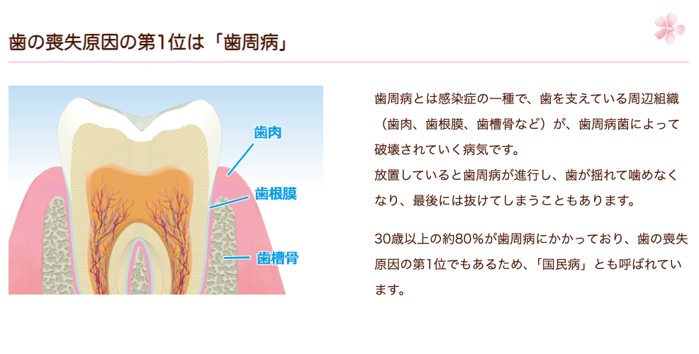 歯周病の進行を防ぐため、患者様の症状に応じた適切な治療と予防ケアを提供しています