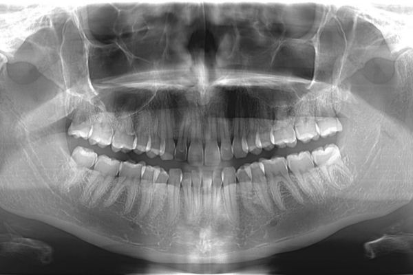 ※画像はイメージです