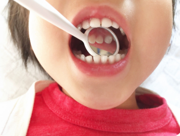 お子様のお口の健康を守りましょう