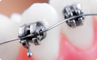 歯科用CTを完備しており精密な矯正治療が可能です