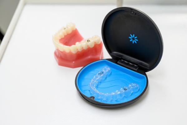 マウスピース矯正に対応しています