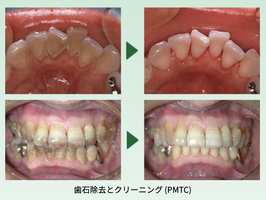 美しさを損なわないように治療いたします。