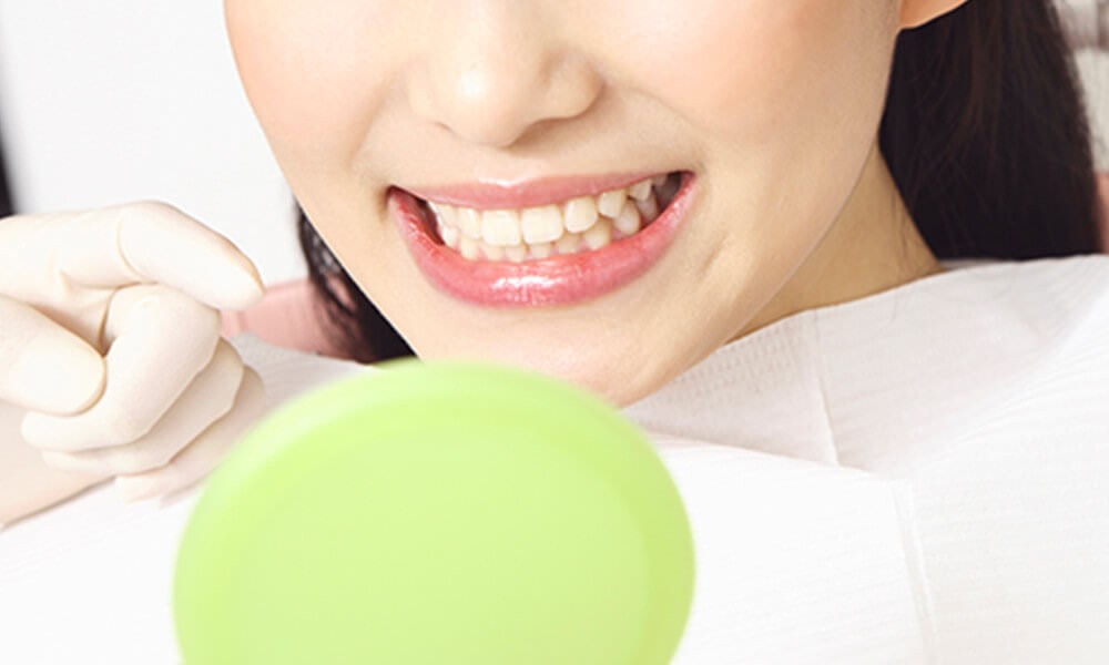 ホームホワイトニングを取り扱っています