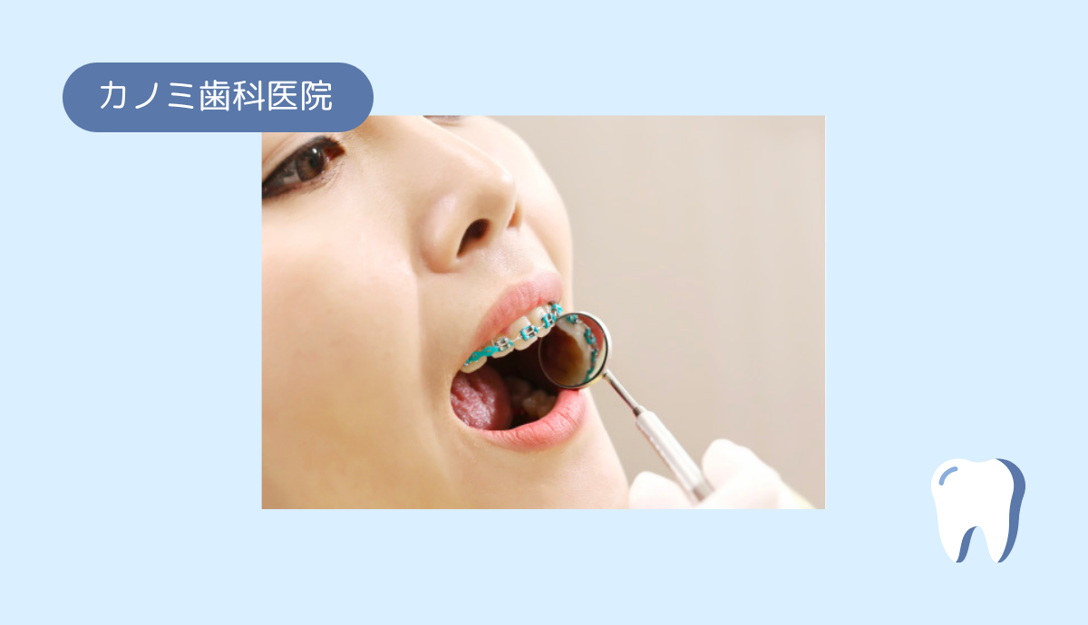 理想の笑顔を手に入れる矯正治療
