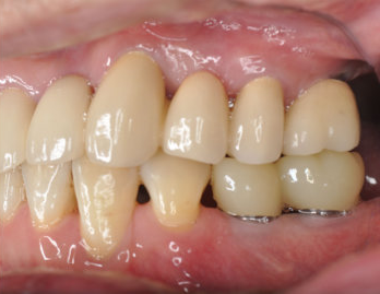 しっかりとした噛み心地をご提供します