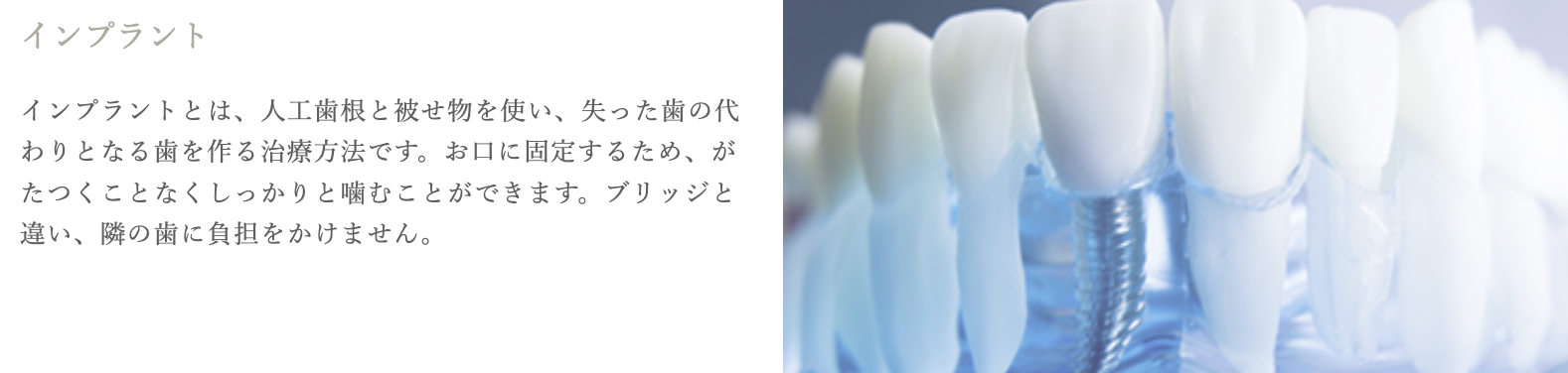 失った歯を補う治療としてインプラントを提供しています