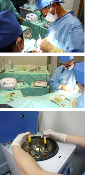 大崎デンタルオフィスでは、インプラント治療を通じて失った歯を補い、自然な噛み合わせと美しい見た目を取り戻すことを目指しています