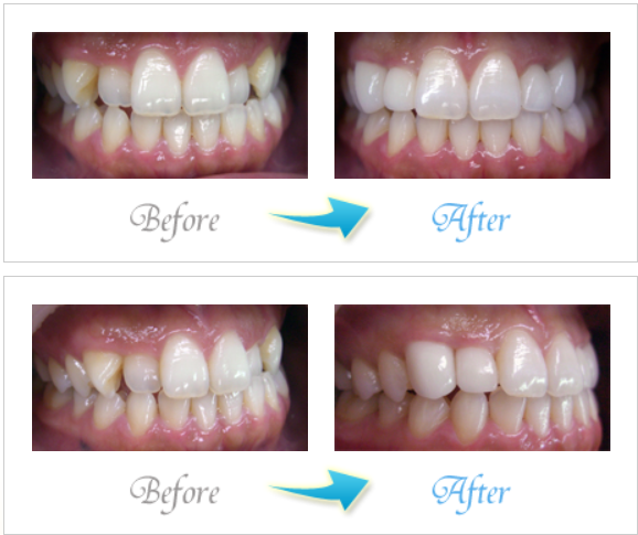 歯並びのお悩みも、一人ひとり丁寧に伺います