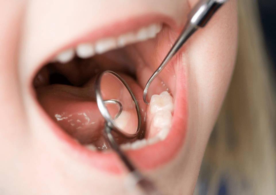 小児歯科治療を提供