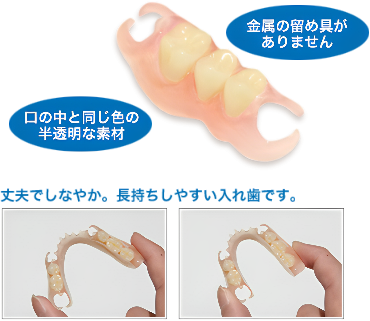 金属アレルギーの方でも安心して利用可能