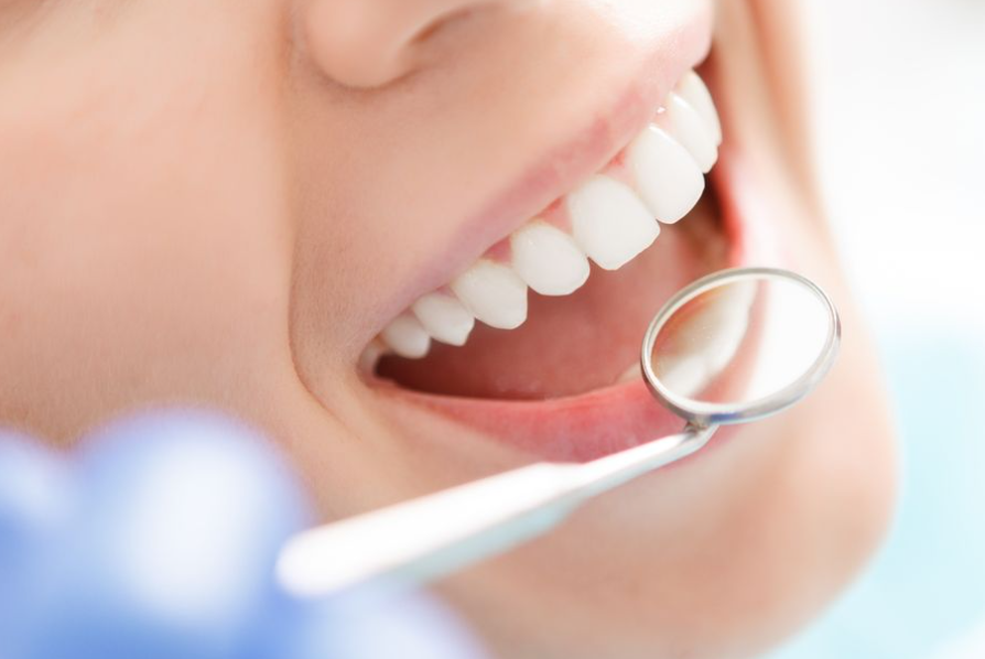 専門的な予防ケアで、虫歯・歯周病を予防します