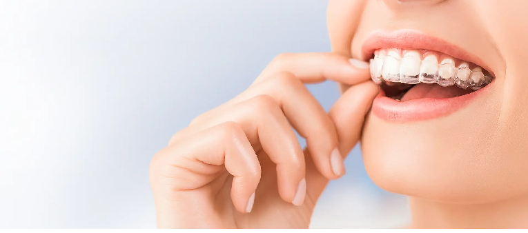 見た目も機能も整う歯並びへ