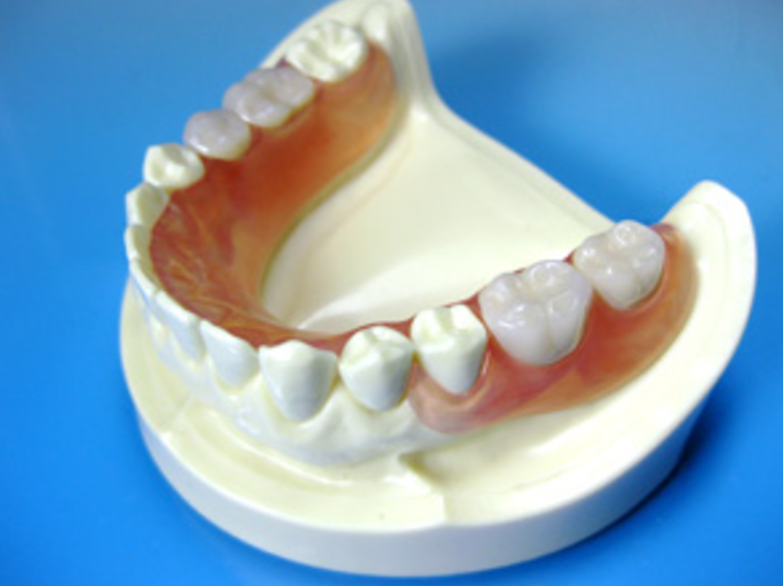 機能的で美しい入れ歯を提供いたします