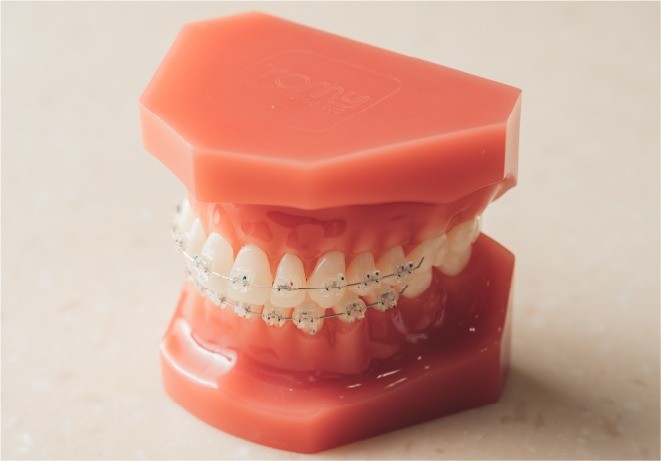 審美性と治療効果の両立を重視した矯正方法として、幅広い年代の方に選ばれています。