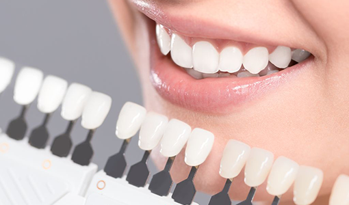 最適なホワイトニング治療方法を提案いたします