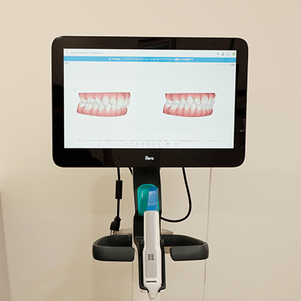 3D光学スキャナー