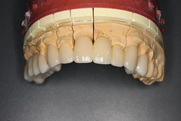 患者様に合わせた審美治療を提供し、自然で美しい仕上がりをお届けします。