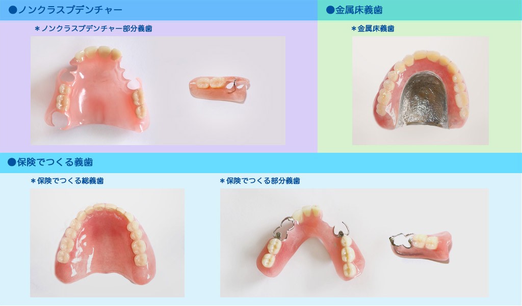 状況によって義歯が選べます