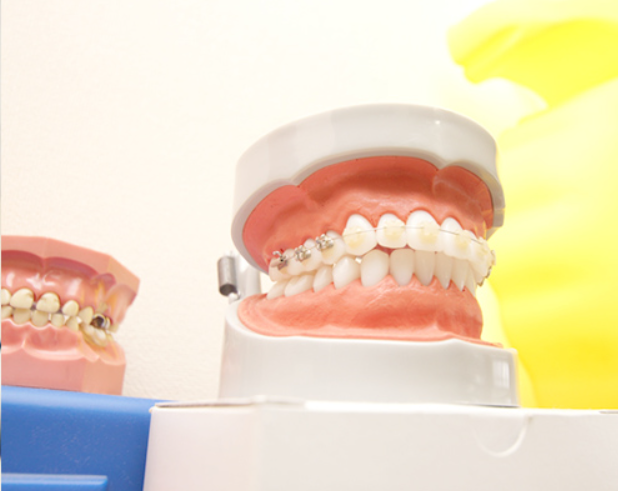 患者様のお口に合った矯正装置をご提案します