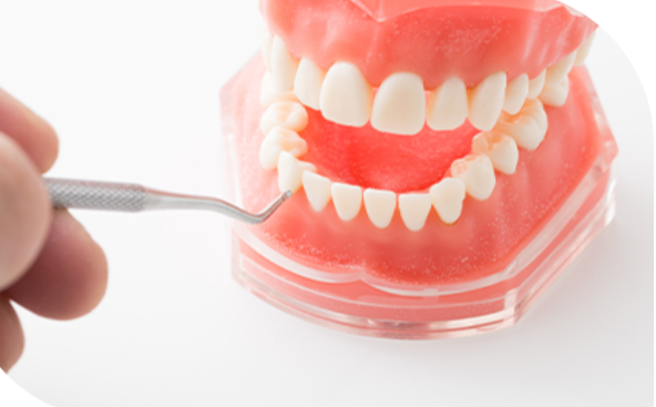 歯周病には早期発見と早期治療が大切です