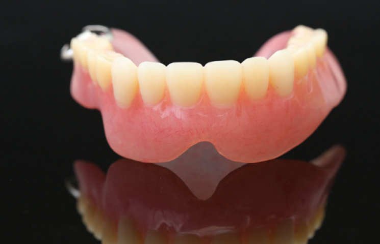 食事も会話も楽しめる入れ歯