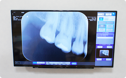 治療内容を視覚的に分かりやすくするためにモニターを設置しています
