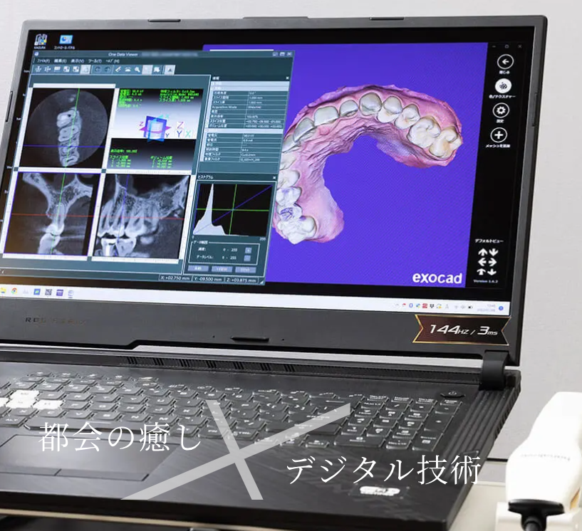 デジタル技術を活用したスピーディな補綴治療を行っております