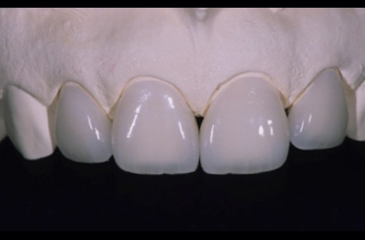 専任技工士が在籍し、仕上がりにも精度とスピードを両立