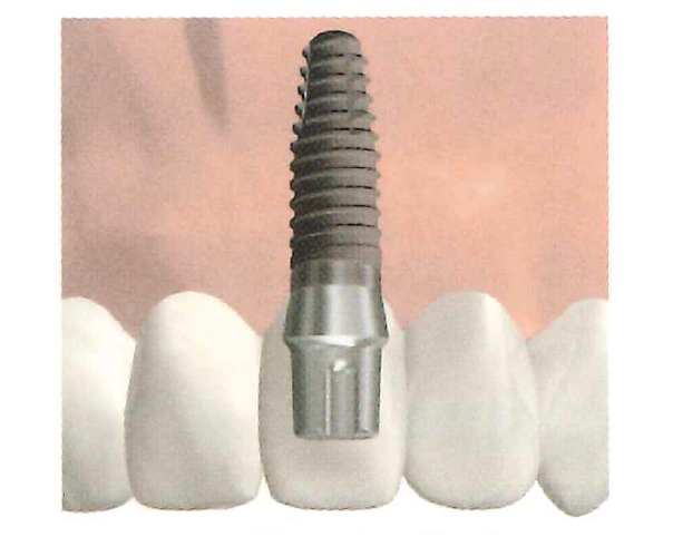 自分の歯のように噛める安心