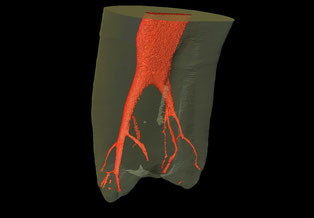 外科的治療で治す方法があります