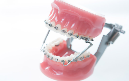 きれいな歯並びは、健康のためにも大切です