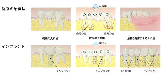 歯科用CTで三次元画像を確認し、精密な治療計画を立てています