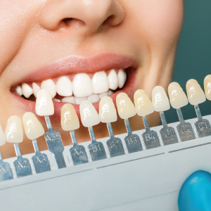 白い歯はそれだけでお顔の印象を若々しく見せます