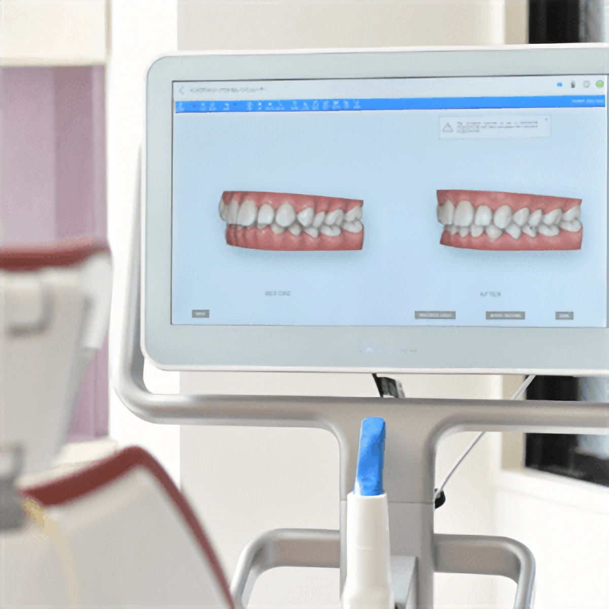 患者様の状態に合わせた最適な歯並びに調整します