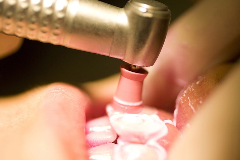 希望する白さや生活スタイルを踏まえ、適切な方法を一緒に検討しています。