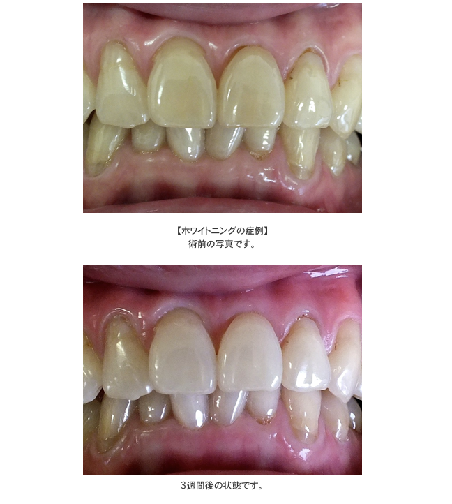 自然な白さを引き出すサポートを行っています