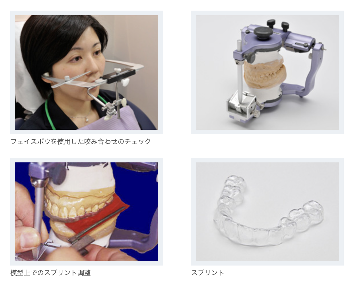 噛み合わせ治療