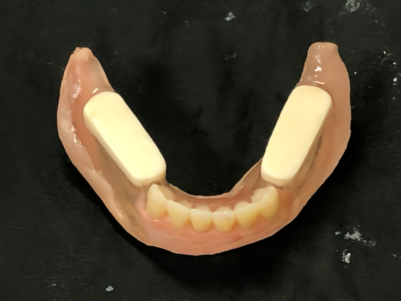 歯科衛生士によるクリーニングを行っています