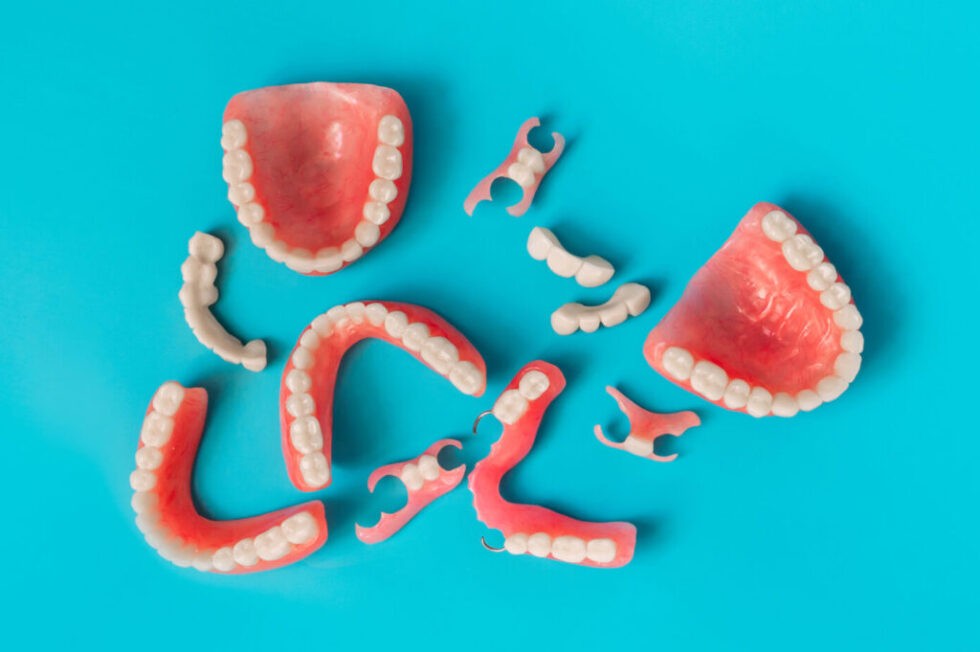 患者様のご希望や生活スタイルを考慮しながら治療方法を提案しています