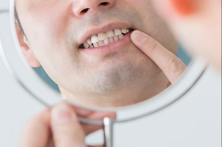 歯周病の早期発見・早期ケアを大切にしています。