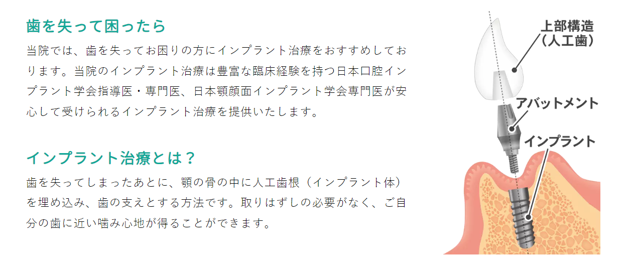 高水準のインプラント治療
