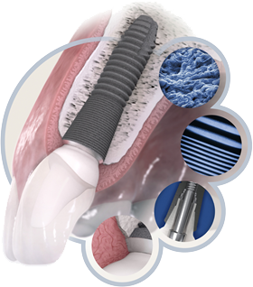 世界基準のインプラント治療を行っています。