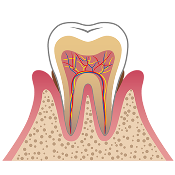 患者様一人一人に合った予防方法を提案し、歯科衛生士が定期的にアドバイスを行います
