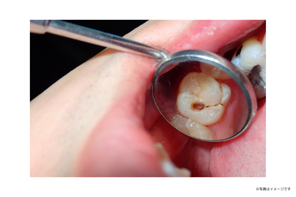 一般的なお口のトラブルに対し、早期発見と早期治療を重視した診療が行われています