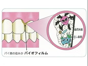 「お口から始まる健康」という考えのもと、PMTCを予防歯科の中心的な取り組みとして位置づけています