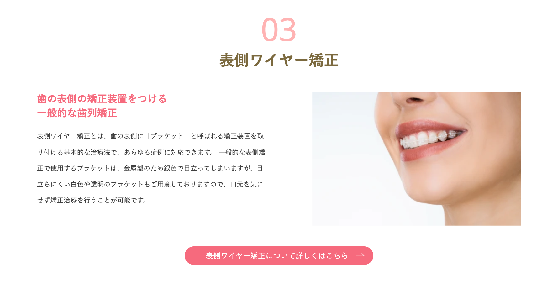 一般的な矯正治療で、多くの症例に対応できるのが特長です