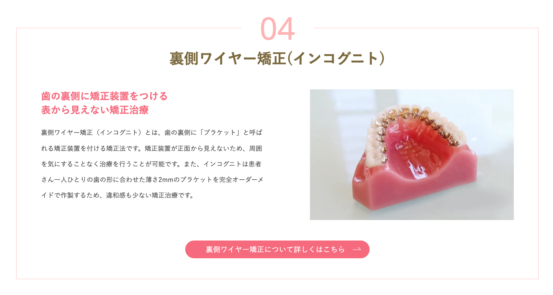 正面から装置が見えないため、周囲の目を気にせず矯正治療を進めることができます