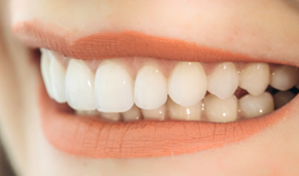 精密なかぶせ物をお作りします